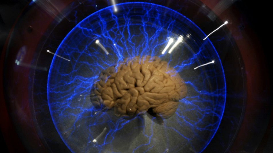Una neuropr&oacute;tesis permite expresarse a un hombre paralizado 