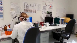 Scoperta l'ameba di fuoco, cresce e si riproduce a 63 gradi