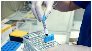 Funziona nei topi la nuova terapia Car-T, non attacca cellule sane