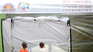 El sida pierde terreno en Sudáfrica, según un estudio