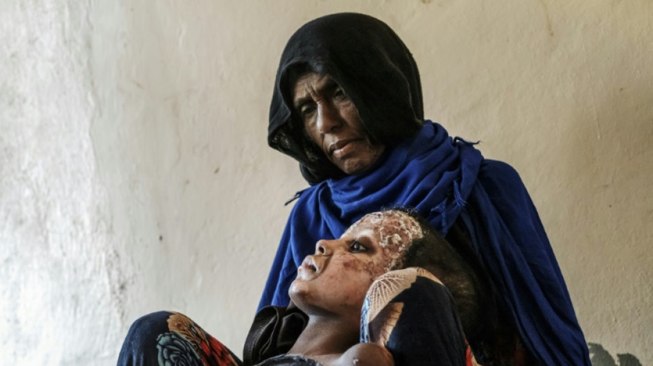 Afar, región del norte de Etiopía olvidada y "saqueada" por la guerra
