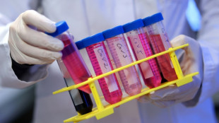 Vaccin&eacute; 217 fois contre le Covid sans effet secondaire: le cas d'un Allemand &eacute;tudi&eacute; par des scientifiques