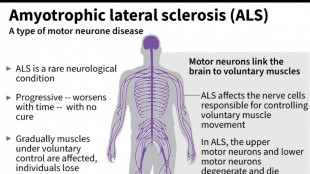 US company withdraws ALS drug after it fails in trial 