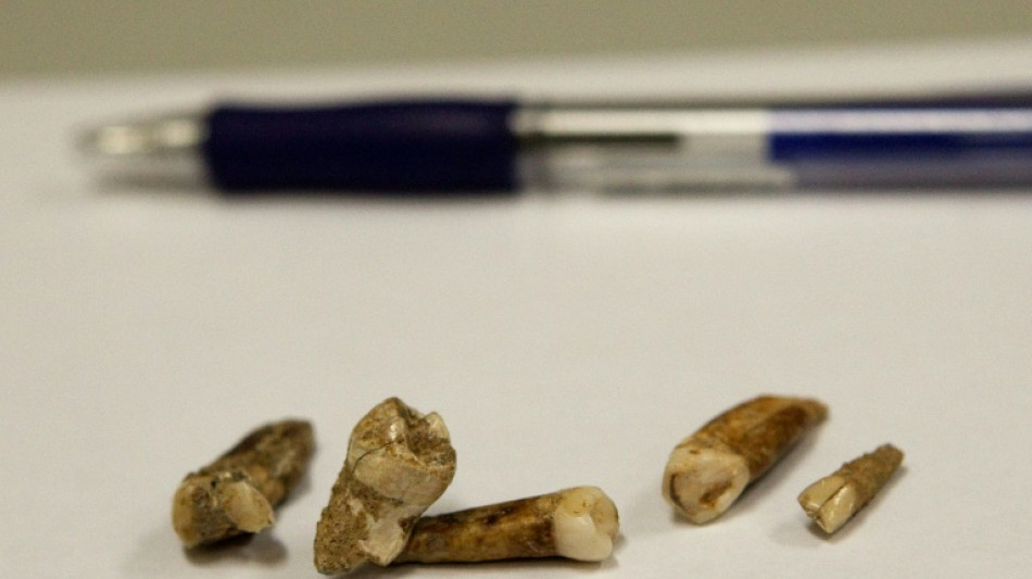 12.000 Jahre alte Zähne von Kind aus Steinzeit in Nordrhein-Westfalen entdeckt