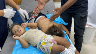 Al menos 21.000 ni&ntilde;os han quedado discapacitados en Gaza desde que comenz&oacute; la guerra, seg&uacute;n un comit&eacute; de la ONU