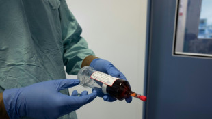 Chimioth&eacute;rapie: une &eacute;tude apporte l'espoir d'une administration simplifi&eacute;e 