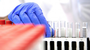 Científicos chinos presentan un nuevo test anticovid ultrarrápido