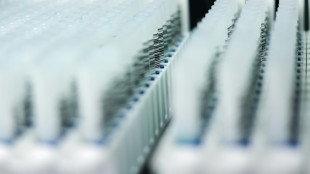 Endom&eacute;triose: premier pas dans la prise en charge d'un test salivaire "prometteur"