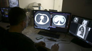 Cancer du poumon: les autorités sanitaires entrouvrent la voie à un dépistage généralisé