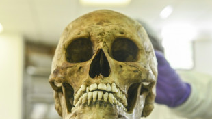 Rheinland-Pfalz: Kinder finden menschlichen Sch&auml;del in Geb&uuml;sch neben Spielplatz