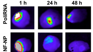 Una nanoparticella per cure innovative grazie a trasporto Rna