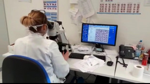 Cervello pi&ugrave; giovane grazie a una rete efficiente di spazzini