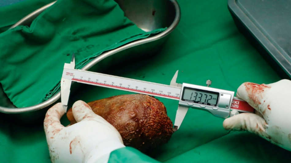 Le plus gros calcul r&eacute;nal du monde retir&eacute; au Sri Lanka