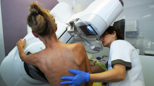 Brustkrebsvorsorge: Mammographie künftig auch für 70- bis 75-jährige Frauen