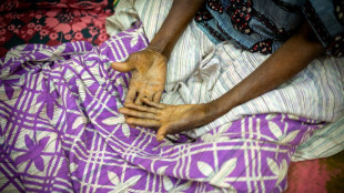 A Bangui, l'hôpital de la dernière chance pour les malades du sida