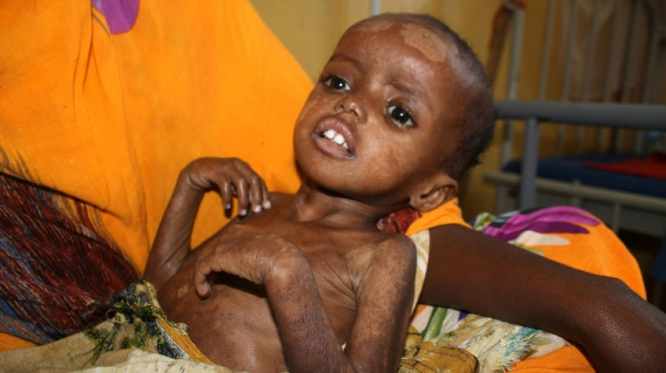 Agotados por el hambre, los niños somalíes no tienen fuerzas para llorar