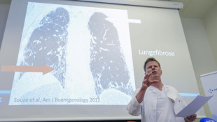La princesa noruega Mette-Marit, en lista de espera para un trasplante pulmonar