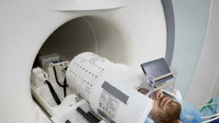 El IRM más potente del mundo muestra sus primeras imágenes del cerebro humano