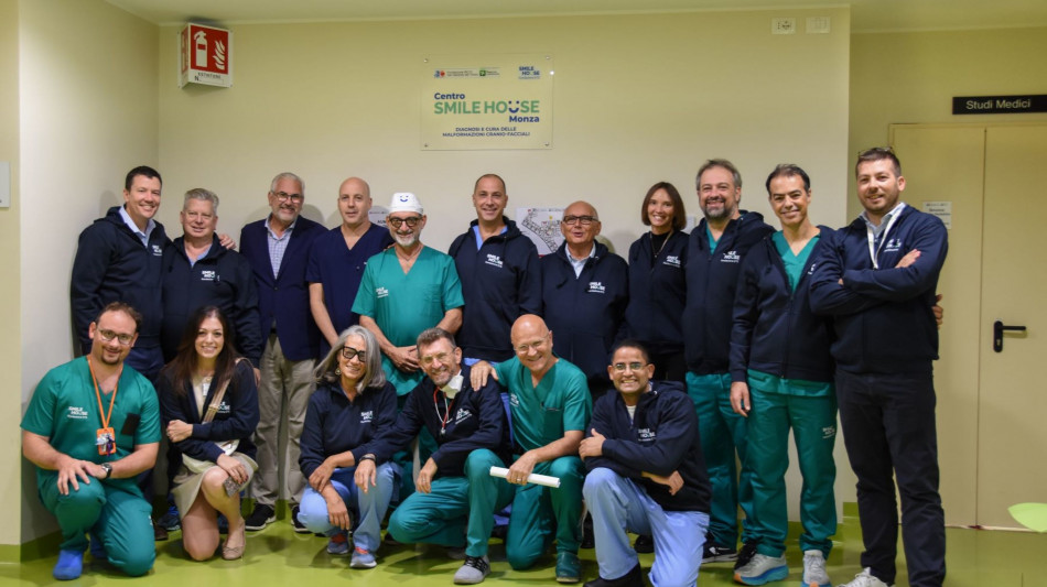 Separate gemelline siamesi attaccate da testa, una &egrave; morta