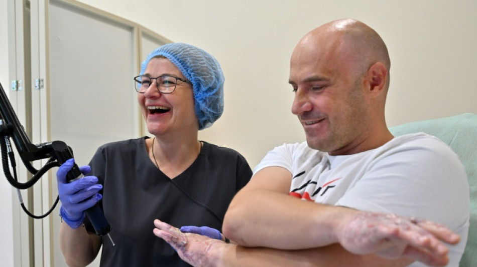 En Ukraine, des grands br&ucirc;l&eacute;s de la guerre soign&eacute;s gratuitement