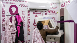 EEUU recomienda las mamografías a partir de los 40 años