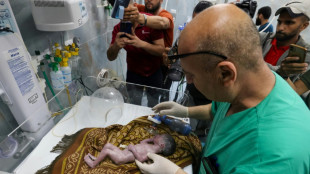 Médicos de Gaza salvam bebê por meio de cesárea