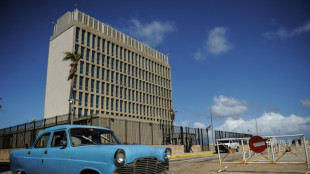 La CIA desestima que "síndrome de La Habana" pueda atribuirse a un gobierno extranjero