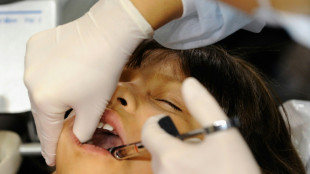 Countries agree to end mercury tooth fillings by 2034