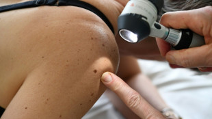 RKI: Etwa 517.800 Menschen erhielten 2023 Krebsdiagnose - Sterblichkeit r&uuml;ckl&auml;ufig