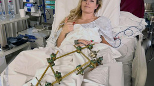 Milano Cortina: Vonn altro intervento 'sei ore e tante viti, ce la far&ograve;'