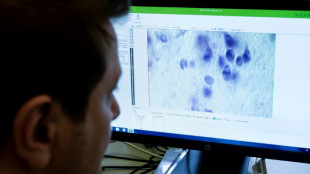 El estremecedor pasado de la mayor colecci&oacute;n de cerebros del mundo en Dinamarca