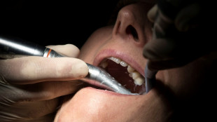 Barmer-Report: Zu viele Zahnbehandlungen bei Teil der Versicherten