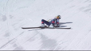 JO: Lindsey Vonn affirme que sa jambe a &eacute;t&eacute; "sauv&eacute;e de l'amputation"